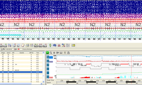 CPAP/BiPAP Study